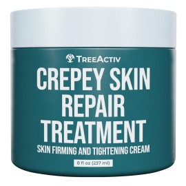 TreeActiv Crepey Skin Repair Cream, 8 oz, Firming Formula with Hyaluronic Acid & Shea Butter to Deeply Moisturize and Tighten Dry, Wrinkly Crepe Skin, 500+ Uses