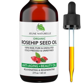 Rosehip Oil - Pure, Virgin, Cold Pressed - From Whole Berries (Pulp & Seeds), Natural Deep Orange Hue for Intensive Skin Repair - Undiluted Organic Rosehip Seed Oil, 2 oz