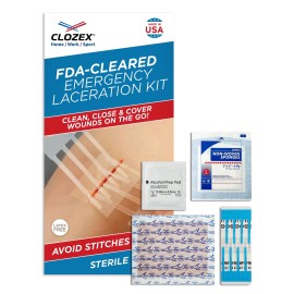 Clozex Emergency Laceration Kit - Repair Wounds Without Stitches, Skin Closure Device for a Wound Up to 1 1/2 Inches Length. Complete Kit to Clean, Close, & Cover Wounds