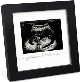 KeaBabies Baby Sonogram Picture Frame - Modern Ultrasound Picture Frames for Mom to Be, First Pregnancy Gifts for Expecting Mom & First Time Dad, Baby Gender Reveal Gifts (Onyx Black)