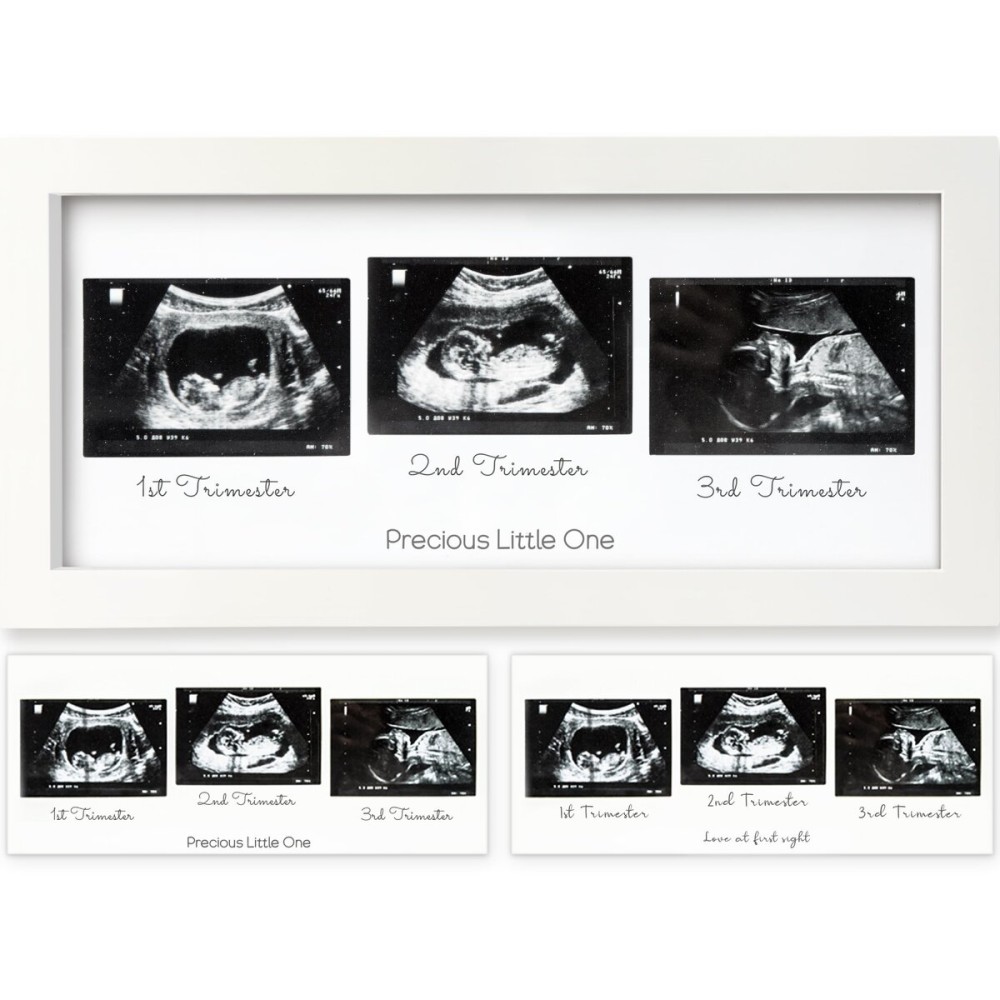 KeaBabies Baby Sonogram Picture Frames - Trio Ultrasound Picture Frames, First Time Mom Gift, Cute Pregnancy Reveal Photo Frame, Baby Gender Reveal Gift, Newborn Nursery Decor (Alpine White)