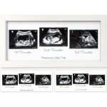 KeaBabies Baby Sonogram Picture Frames - Trio Ultrasound Picture Frames, First Time Mom Gift, Cute Pregnancy Reveal Photo Frame, Baby Gender Reveal Gift, Newborn Nursery Decor (Alpine White)