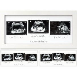 KeaBabies Baby Sonogram Picture Frames - Trio Ultrasound Picture Frames, First Time Mom Gift, Cute Pregnancy Reveal Photo Frame, Baby Gender Reveal Gift, Newborn Nursery Decor (Alpine White)