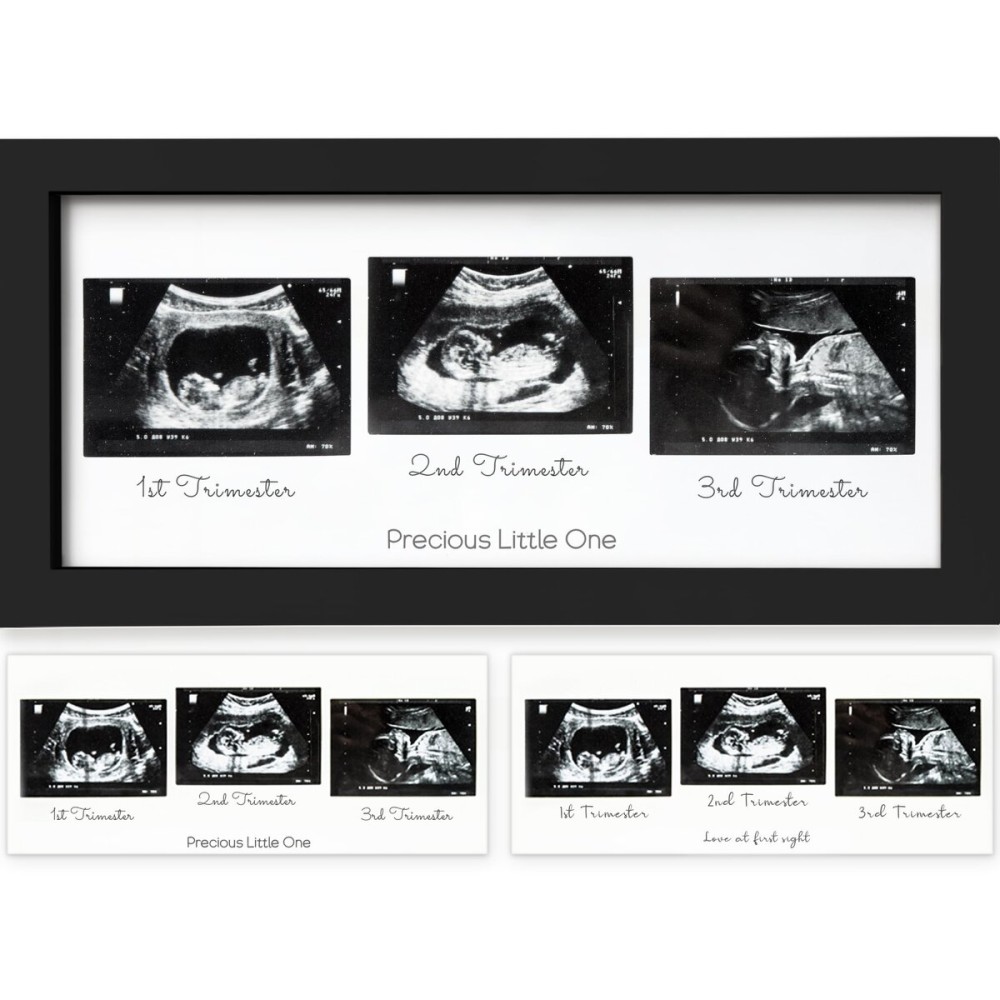 KeaBabies Baby Sonogram Picture Frames - Trio Ultrasound Picture Frames, First Time Mom Gift, Cute Pregnancy Reveal Photo Frame, Baby Gender Reveal Gift,Newborn Nursery Decor(Onyx Black)