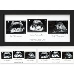 KeaBabies Baby Sonogram Picture Frames - Trio Ultrasound Picture Frames, First Time Mom Gift, Cute Pregnancy Reveal Photo Frame, Baby Gender Reveal Gift,Newborn Nursery Decor(Onyx Black)