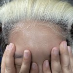 BEEOS 5x5 Skinlike Real HD Lace Closure Only, 613 Blonde 0.10mm Ultra-thin Invisible Swiss Lace Ultimate Human Hair Closure Pre-Plucked Natural Hairline Silky Straight 20 Inch