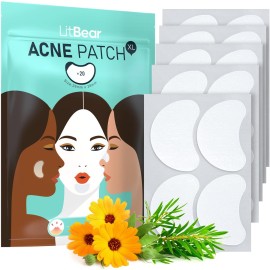 LitBear Acne Patches Large, Hydrocolloid Pimple Patches for Breakouts, Zit and Blemish, Large Acne Patches for Face, Chin, Back and Body with Tea Tree & Calendula Oil
