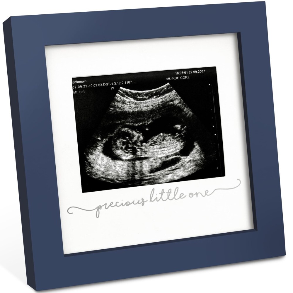 KeaBabies Baby Sonogram Picture Frame - Modern Ultrasound Picture Frames for Mom to Be, First Pregnancy Gifts for Expecting Mom & First Time Dad, Baby Gender Reveal Gifts (Midnight Blue)
