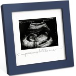 KeaBabies Baby Sonogram Picture Frame - Modern Ultrasound Picture Frames for Mom to Be, First Pregnancy Gifts for Expecting Mom & First Time Dad, Baby Gender Reveal Gifts (Midnight Blue)