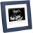 KeaBabies Baby Sonogram Picture Frame - Modern Ultrasound Picture Frames for Mom to Be, First Pregnancy Gifts for Expecting Mom & First Time Dad, Baby Gender Reveal Gifts (Midnight Blue)