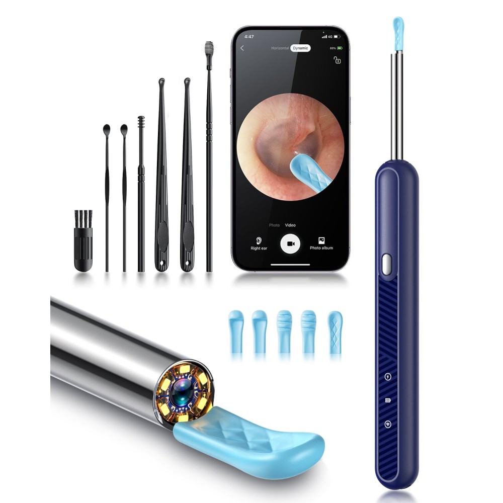 Loyker Ear Wax Removal Tool Camera, Ear Cleaner with 1080P Camera, Earwax Removal Cleaning Kit with 6 Ear Pick, Otoscope for iPhone, iPad, Android Phones, Blue