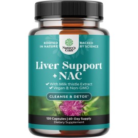 Liver Support NAC Supplement with Milk Thistle for Liver Cleanse Detox & Repair - N Acetyl Cysteine Supplement Liver Cleanse with Antioxidants, Turmeric, Choline, Dandelion & L-Glutathione - 120 Caps