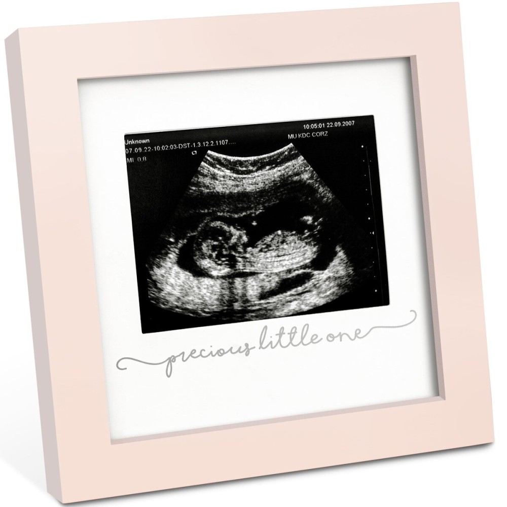KeaBabies Baby Sonogram Picture Frame - Modern Ultrasound Picture Frames for Mom to Be, First Pregnancy Gifts for Expecting Mom & First Time Dad, Baby Gender Reveal Gifts (Petal Pink)
