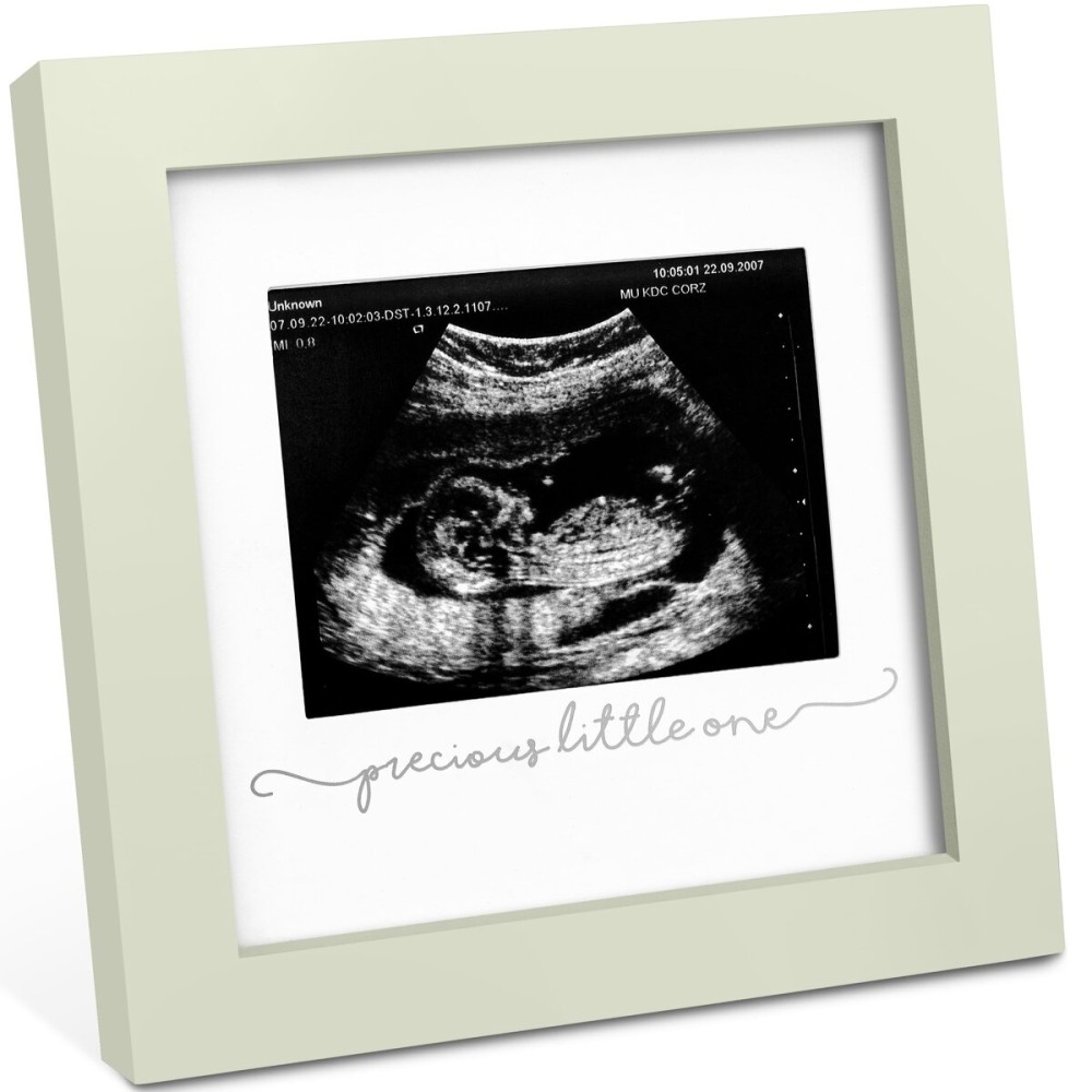 KeaBabies Baby Sonogram Picture Frame - Modern Ultrasound Picture Frames for Mom to Be, First Pregnancy Gifts for Expecting Mom & First Time Dad, Baby Gender Reveal Gifts(Sage)