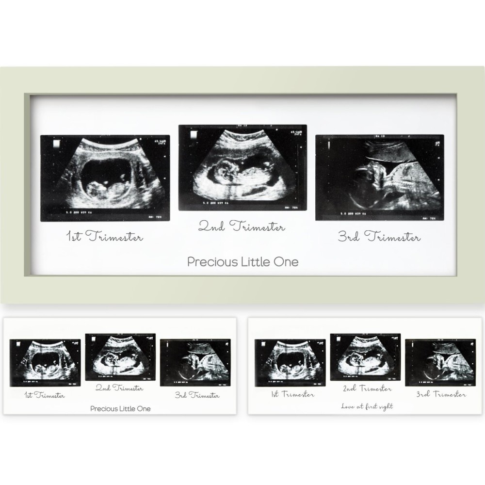 KeaBabies Baby Sonogram Picture Frames - Trio Ultrasound Picture Frames, First Time Mom Gift, Cute Pregnancy Reveal Photo Frame, Baby Gender Reveal Gift, Newborn Nursery Decor (Sage)