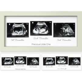 KeaBabies Baby Sonogram Picture Frames - Trio Ultrasound Picture Frames, First Time Mom Gift, Cute Pregnancy Reveal Photo Frame, Baby Gender Reveal Gift, Newborn Nursery Decor (Sage)