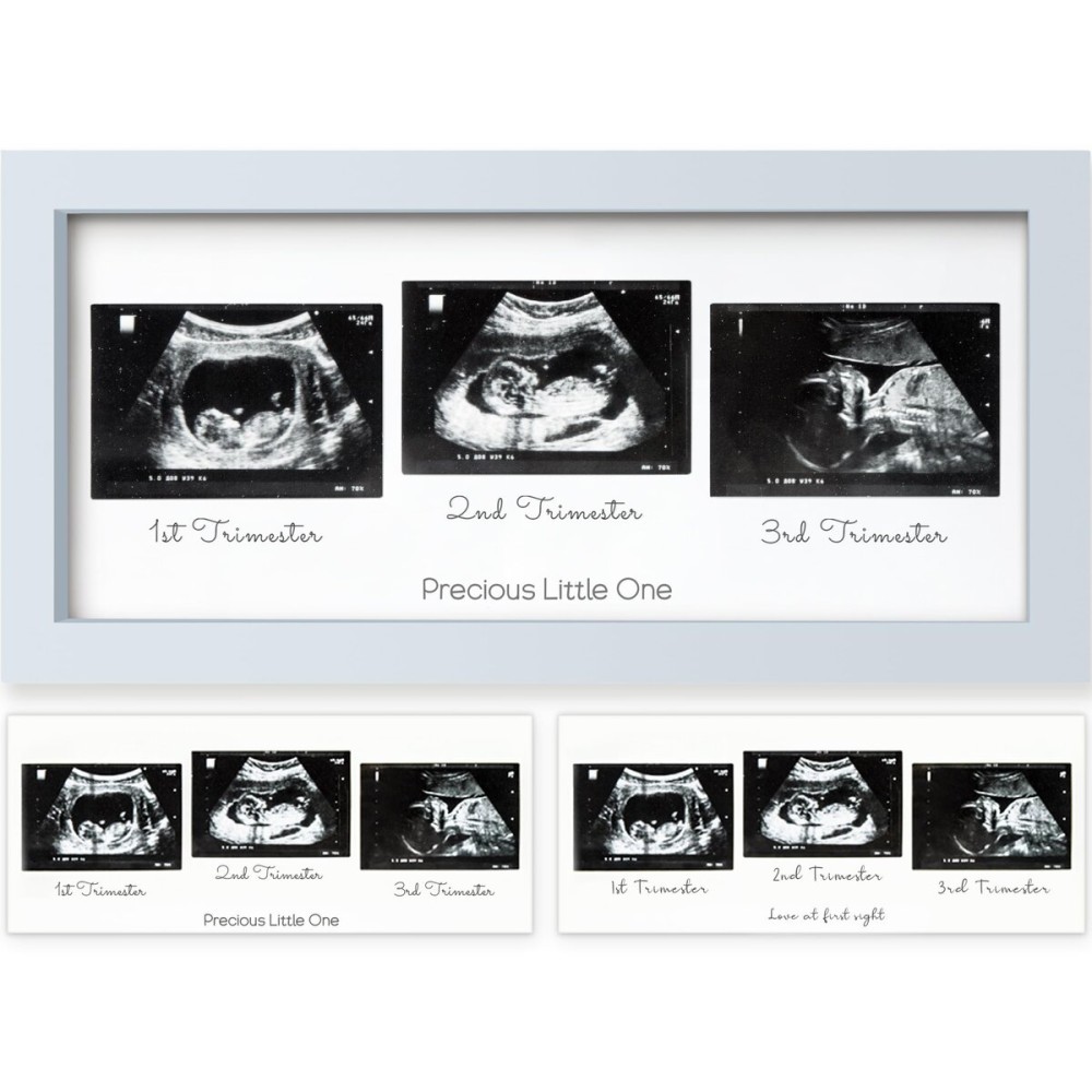KeaBabies Baby Sonogram Picture Frames - Trio Ultrasound Picture Frames, First Time Mom Gift, Cute Pregnancy Reveal Photo Frame, Baby Gender Reveal Gift, Newborn Nursery Decor (Mist Blue)