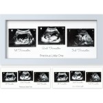 KeaBabies Baby Sonogram Picture Frames - Trio Ultrasound Picture Frames, First Time Mom Gift, Cute Pregnancy Reveal Photo Frame, Baby Gender Reveal Gift, Newborn Nursery Decor (Mist Blue)