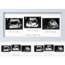 KeaBabies Baby Sonogram Picture Frames - Trio Ultrasound Picture Frames, First Time Mom Gift, Cute Pregnancy Reveal Photo Frame, Baby Gender Reveal Gift, Newborn Nursery Decor (Mist Blue)