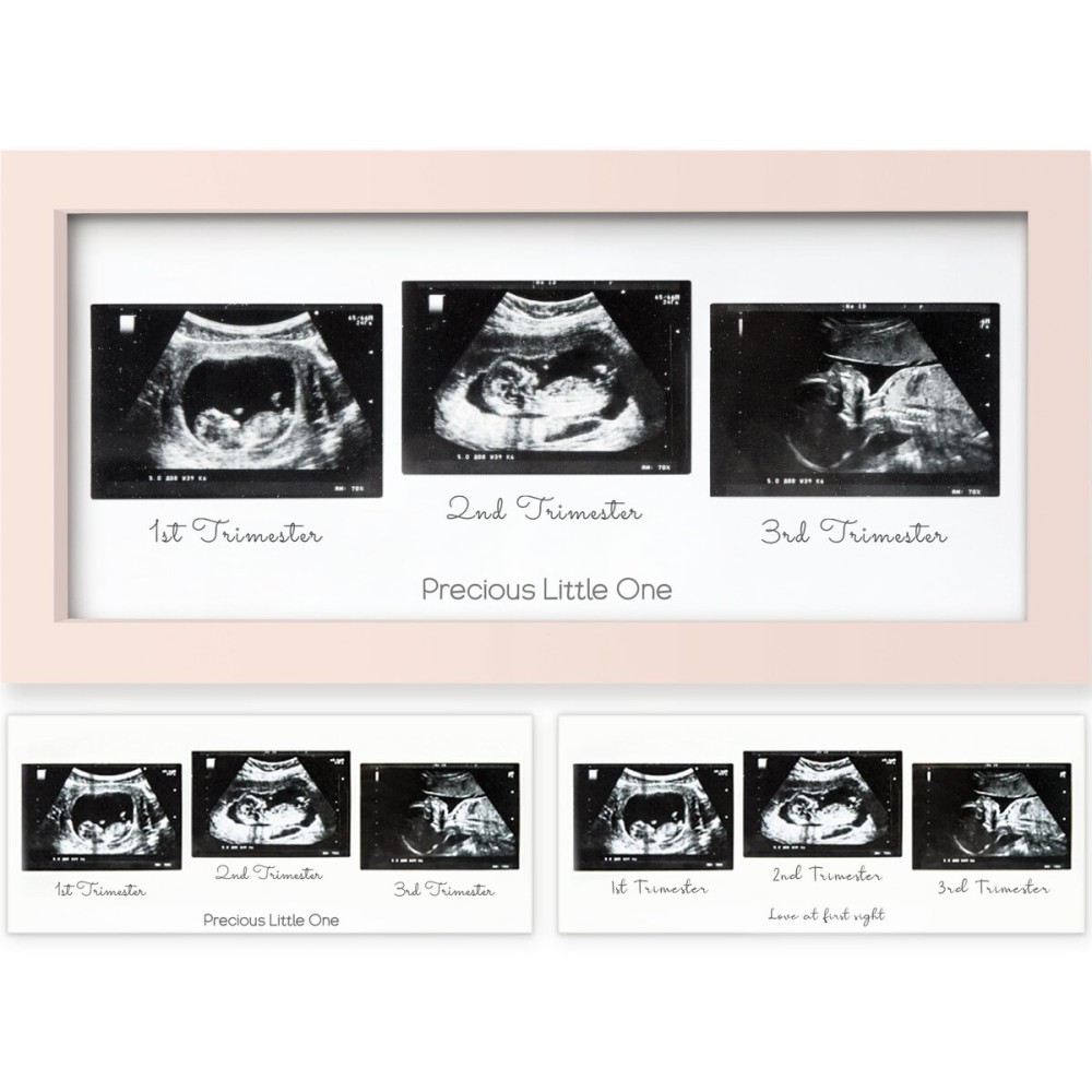 KeaBabies Baby Sonogram Picture Frames - Trio Ultrasound Picture Frames, First Time Mom Gift, Cute Pregnancy Reveal Photo Frame, Baby Gender Reveal Gift, Newborn Nursery Decor (Petal Pink)