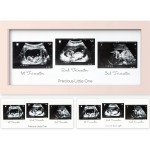 KeaBabies Baby Sonogram Picture Frames - Trio Ultrasound Picture Frames, First Time Mom Gift, Cute Pregnancy Reveal Photo Frame, Baby Gender Reveal Gift, Newborn Nursery Decor (Petal Pink)