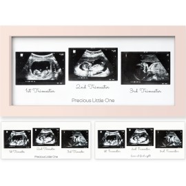 KeaBabies Baby Sonogram Picture Frames - Trio Ultrasound Picture Frames, First Time Mom Gift, Cute Pregnancy Reveal Photo Frame, Baby Gender Reveal Gift, Newborn Nursery Decor (Petal Pink)