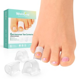 Welnove Hammertoe Corrector - Toe Straightener to Curled Toes, Broken toe, Bunion Corrector for Women and Men, Small*3 Pairs