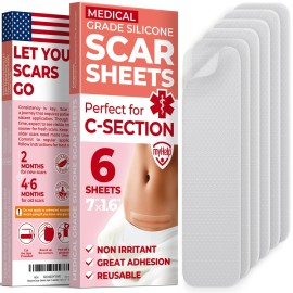 Medical Grade Silicone Scar Sheets - Transparent - 6pk (7x1.6) - Visible Difference on C-Section Scars - Reusable Silicone Sheets for Scars - Easy to Use C Section Scar Silicone Strips