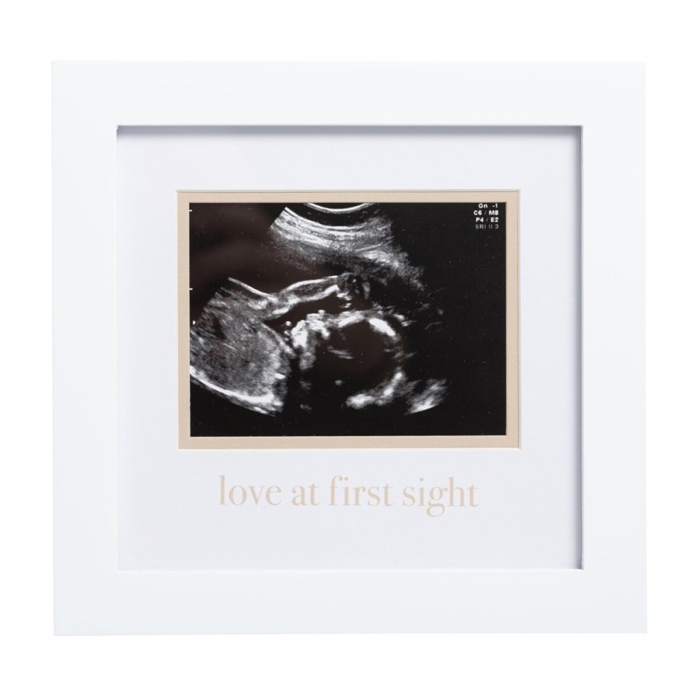 Pearhead Love At First Sight Sonogram Frame, Ultrasound Picture Frame, Pregnancy Announcement Photo Frame, Baby Keepsake Gift For Expecting Parents