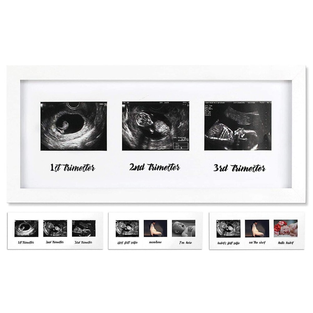 IHEIPYE Triple Sonogram Pregnancy Frame - Baby Ultrasound Picture Frame with Story for Expecting Parents, Baby Grow Through All Three Trimesters Frame, Nursery Decor, White